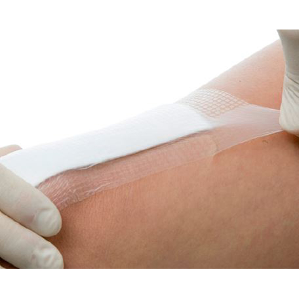 OPSITE◊ Post-Op Waterproof Dressings